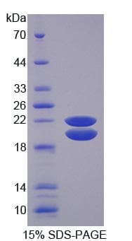 Pig IGFBP3 Protein (Recombinant His-T7)