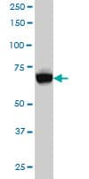 ACS5 / ACSL5 Antibody (clone 5H8)