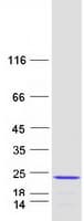 Human HMGIY / HMGA1 Protein (Recombinant Myc-DDK (Flag))