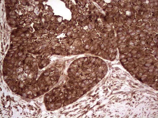 YBX1 / YB1 Antibody (clone OTI7B4)