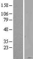 KRTAP20-1 Protein (Over-Expression Lysate Myc-DDK (Flag))