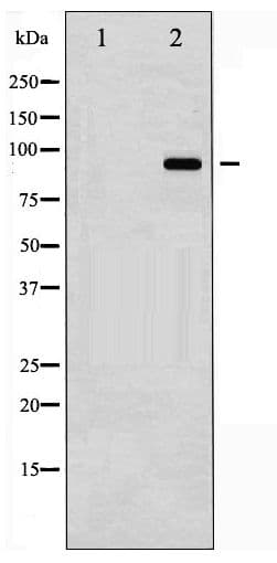 CTNNB1 / Beta Catenin Antibody (phospho-Tyr489)