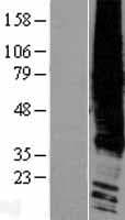 LPAR1 / LPA1 / EDG2 Protein (Over-Expression Lysate Myc-DDK (Flag))