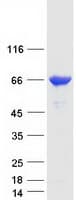 Human GRK6 Protein (Recombinant Myc-DDK (Flag))