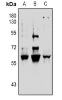 Polyclonal Rabbit anti-Human Vimentin Antibody (WB)