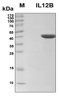 Human IL12B / IL12 p40 Protein (Recombinant 6His, N-terminus)