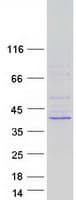 Human NTHL1 Protein (Recombinant Myc-DDK (Flag))