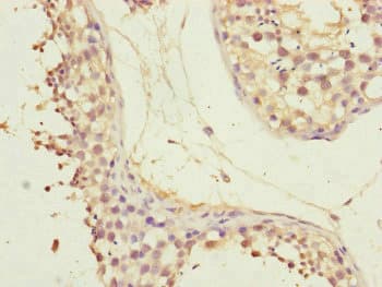 Polyclonal Rabbit anti-Human CEP72 Antibody (IHC, WB)
