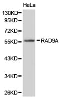 Polyclonal Rabbit anti-Human RAD9A / RAD9 Antibody (IHC, WB)