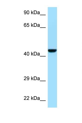 GMPPB Antibody (N-Terminus)