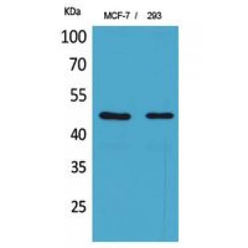 INHBA / Inhibin Beta A Antibody (371-420 aa, C-terminal)