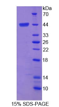 Bovine FGF4 Protein (Recombinant His-GST)
