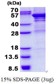 Human UMPS / OPRT Protein (Recombinant His)