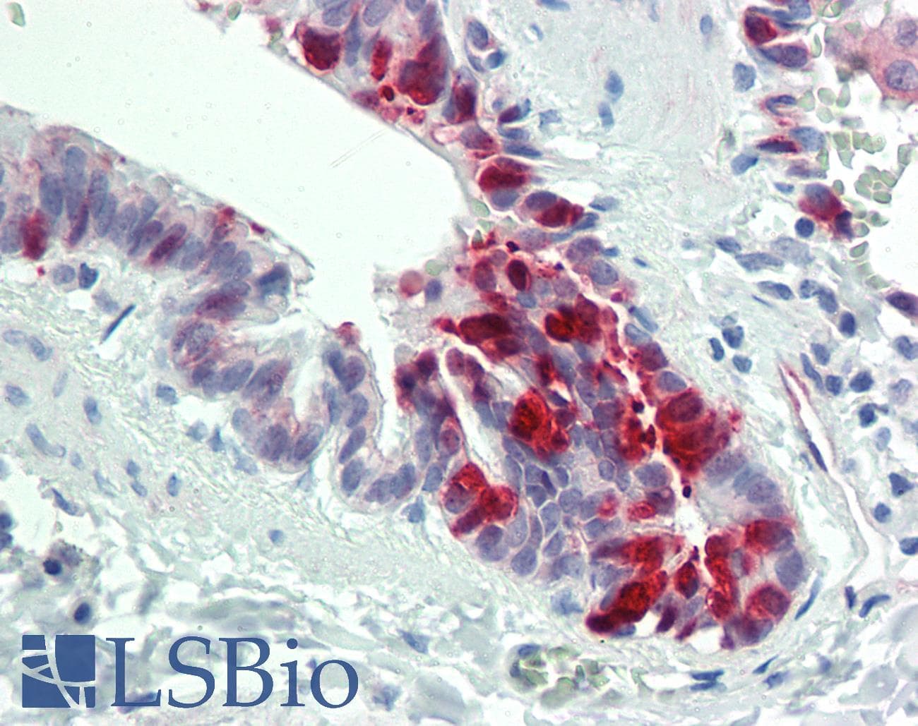Polyclonal Rabbit anti-Human SLPI / Antileukoproteinase Antibody (aa11-60, IHC, WB)