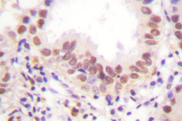 ER Alpha / Estrogen Receptor Antibody (Lys531)