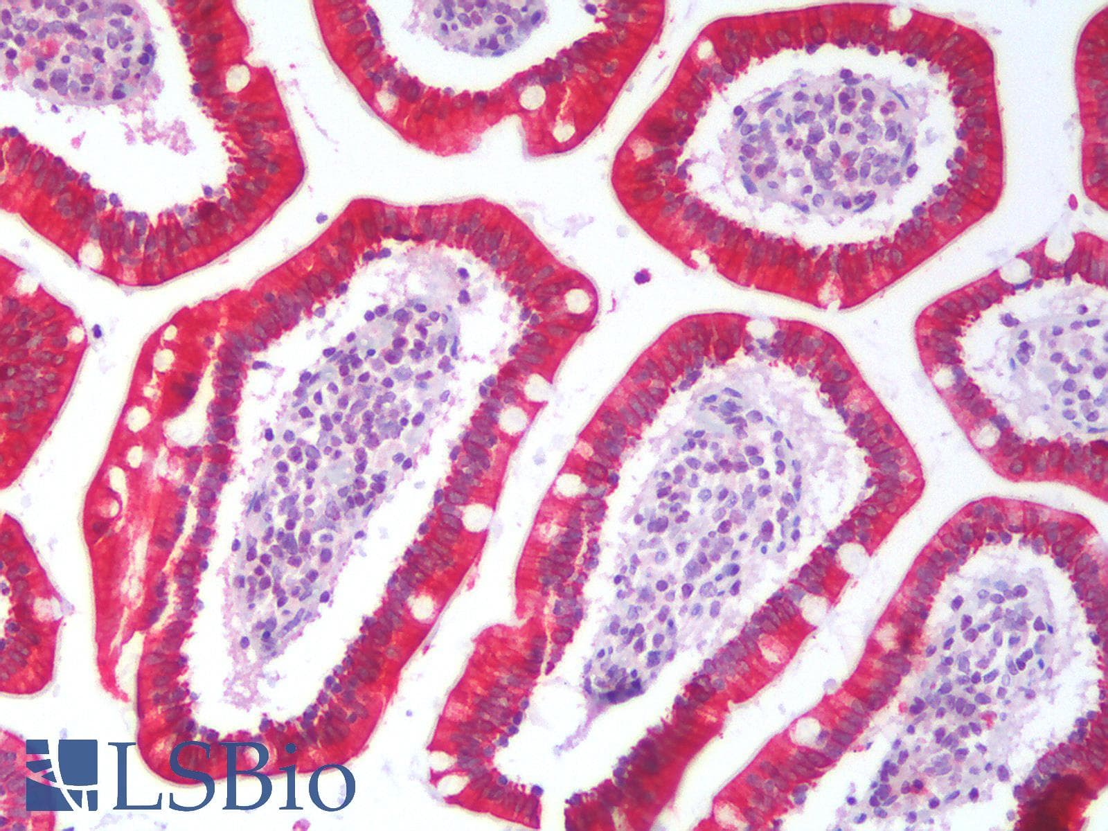 PathPlus™ KRT19 / CK19 / Cytokeratin 19 Antibody