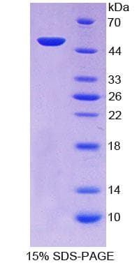 Mouse ZRP-1 / TRIP6 Protein (Recombinant His-GST)