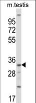SGK494 Antibody (aa71-99)