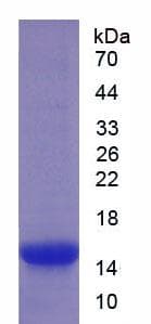 Mouse TIMP1 Protein (Recombinant His)