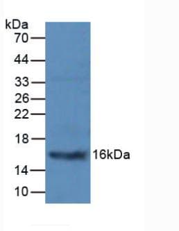 CALCA Antibody