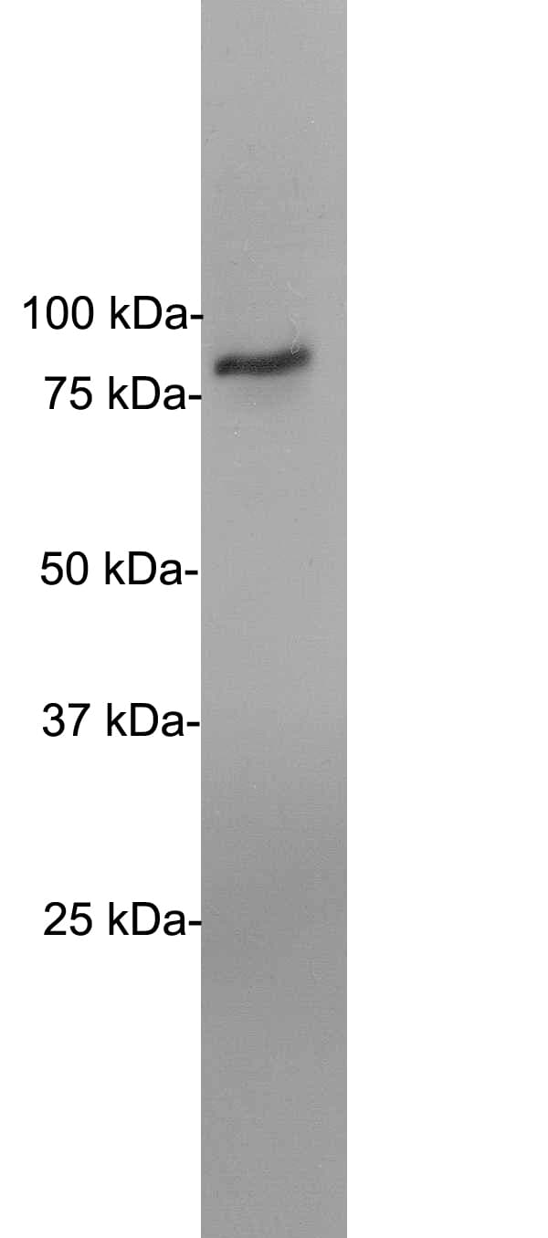 EWSR1 / EWS Antibody (clone 5H7)