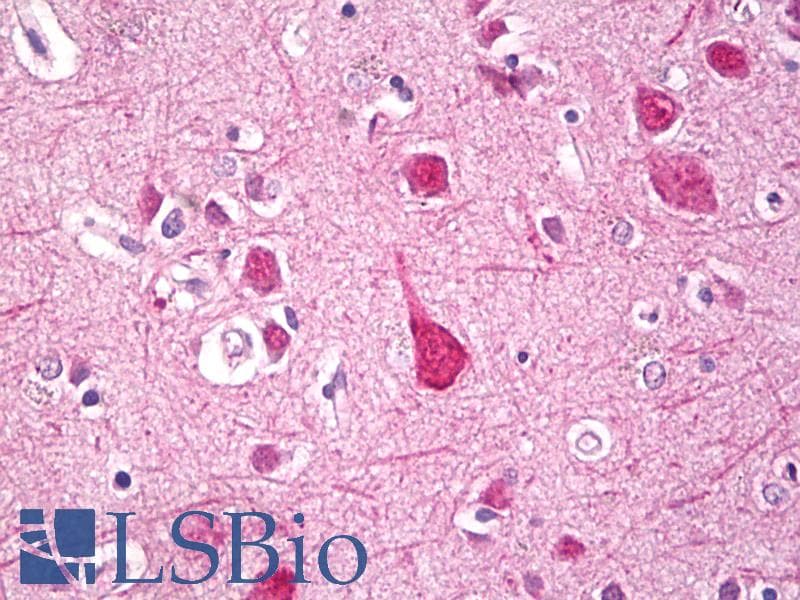 IHC-plus™ ERN1 / IRE1 Antibody