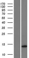 TMEM155 Protein (Over-Expression Lysate Myc-DDK (Flag))