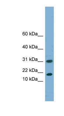 Polyclonal Rabbit anti-Human EIF5A2 Antibody (N-Terminus, WB)