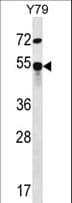 ZFP14 Antibody (aa72-100)