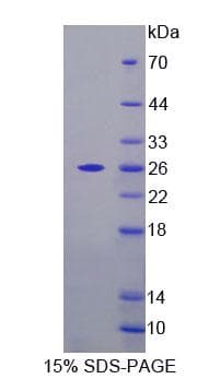 Mouse FPGT Protein (Recombinant His-T7, N-terminus)