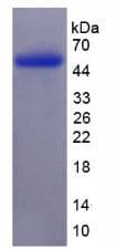 Human ADAMTS13 Protein (Recombinant)