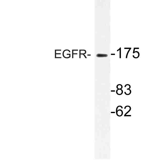 Polyclonal Rabbit anti-Human EGFR Antibody (Pro1019, WB)