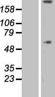 COL8A1 / Collagen VIII Alpha 1 Protein (Over-Expression Lysate Myc-DDK (Flag))