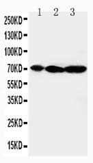 MAP3K2 / MEKK2 Antibody (aa606-619)
