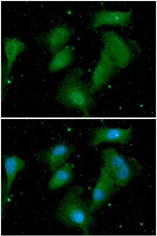AKT1 Antibody (clone AT6D5)