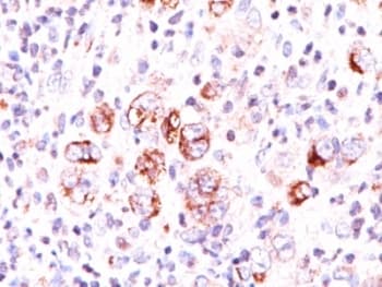 BCL2L1 / BCL-XL Antibody (aa3-14, clone 2H12)