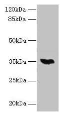 Polyclonal Rabbit anti-Human LYSMD3 Antibody