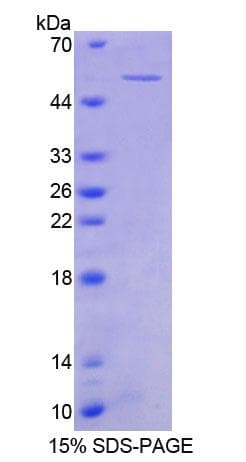 Human CCN3 / NOV Protein (Recombinant His-GST)