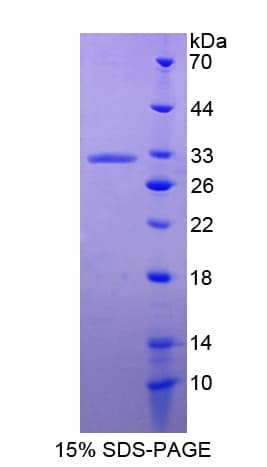 Human ANXA6/Annexin A6/Annexin VI Protein (Recombinant His-T7)
