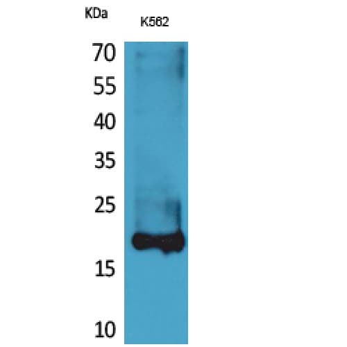 LCN1 / Lipocalin-1 Antibody (Internal)