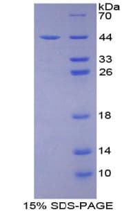 Mouse NISCH Protein (Recombinant His-GST)