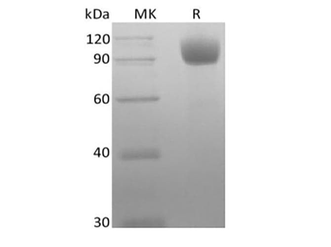 Mouse ACE2 / ACE-2 Protein (Recombinant 10His, C-terminus)