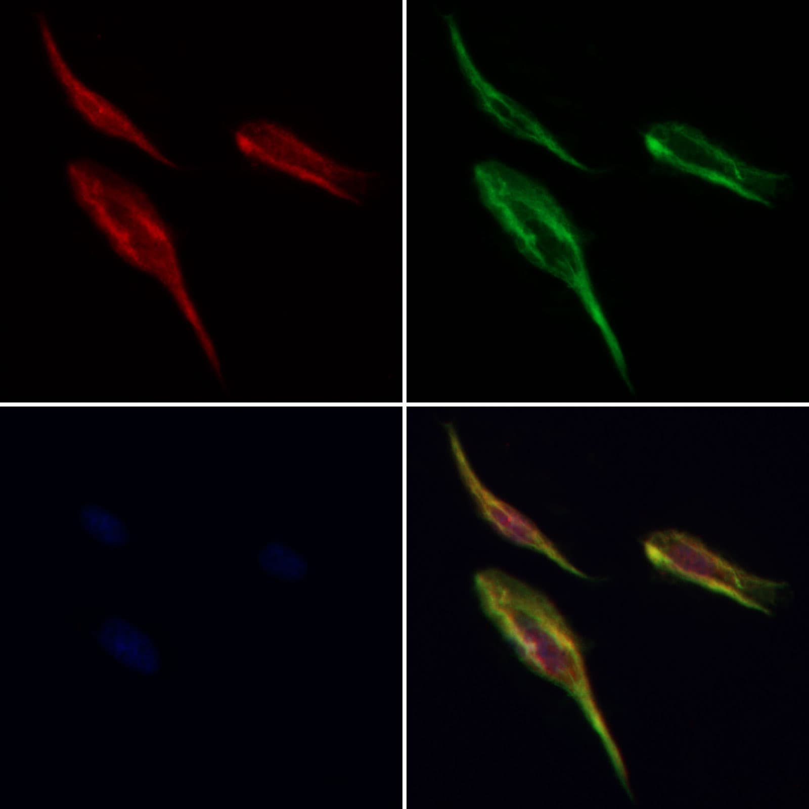 RPN1 / Ribophorin I Antibody