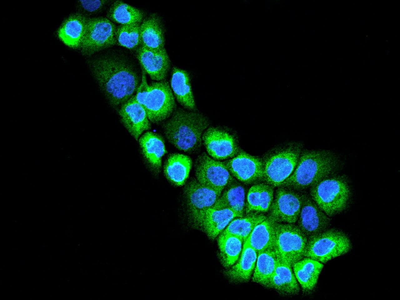 SOAT1 Antibody
