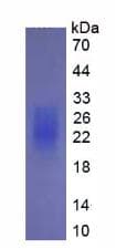 Human IL22 Protein (Recombinant His, N-Terminal)
