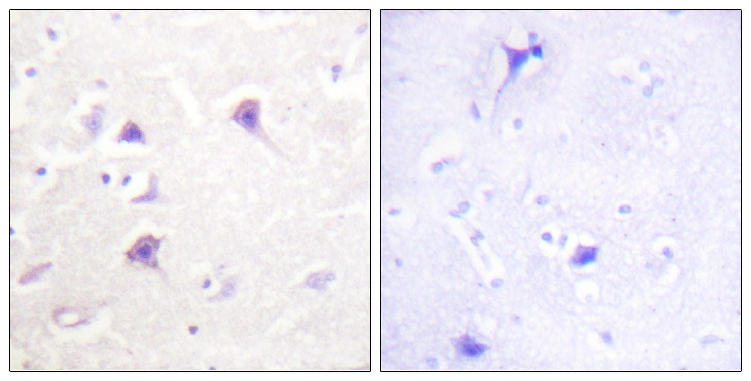 Polyclonal Rabbit anti-Human ERBB4 / HER4 Antibody (Ab-1284, IHC, IF)
