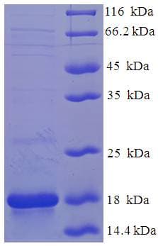 Cynomolgus monkey FXN / Frataxin Protein (Recombinant 6His, N-terminus)