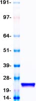 Human SOD1 / Cu-Zn SOD Protein (Recombinant Myc-DDK (Flag))