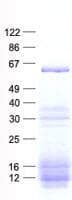 Human MNS1 Protein (Recombinant His, N-Terminal)