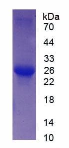 Human TNNI2 Protein (Recombinant His, N-Terminal)